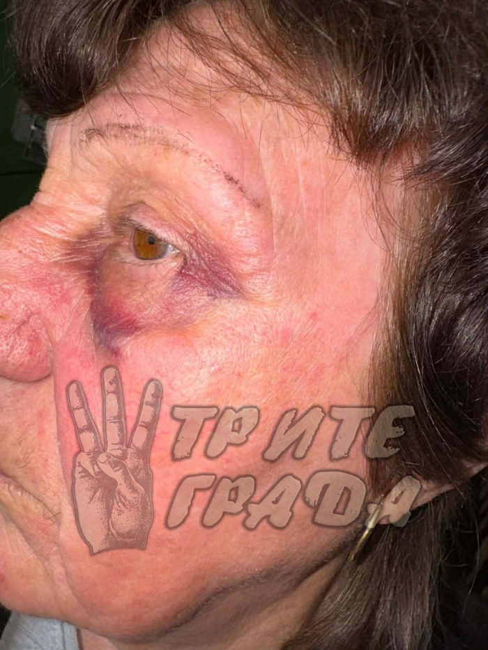 Полицията проверява сигнал за пребита възрастна жена в Лясковец (СНИМКИ+ВИДЕО)